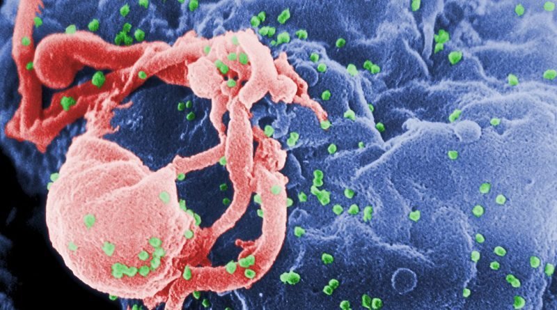 A new hope: doctors learn to treat HIV
