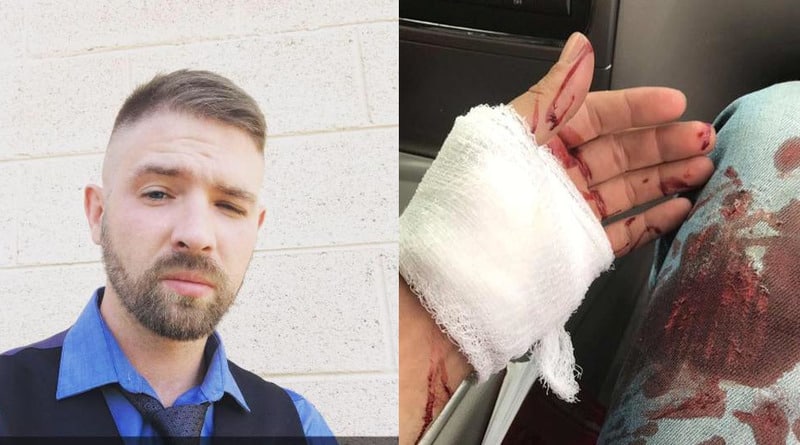 A man was stabbed because of a haircut, «like» the Nazi (photos)