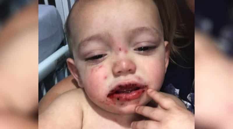 Be careful, cold sores! The mother of the kid Giuliano warns parents