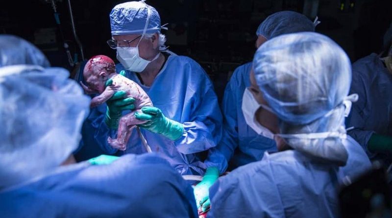 For the first time in the US, a woman born without a uterus, gave birth to a child