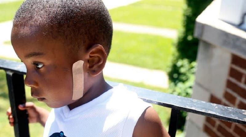 5-year-old boy from Chicago was shot and wounded twice in the last 2 years