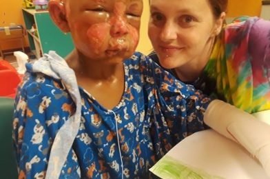 In the US, the child poured 7-year-old boy’s remedy nail Polish remover and set him on fire