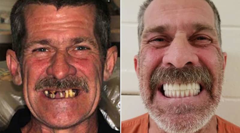 Man stole someone else’s identity to make new teeth for $40 thousand and buy a puppy