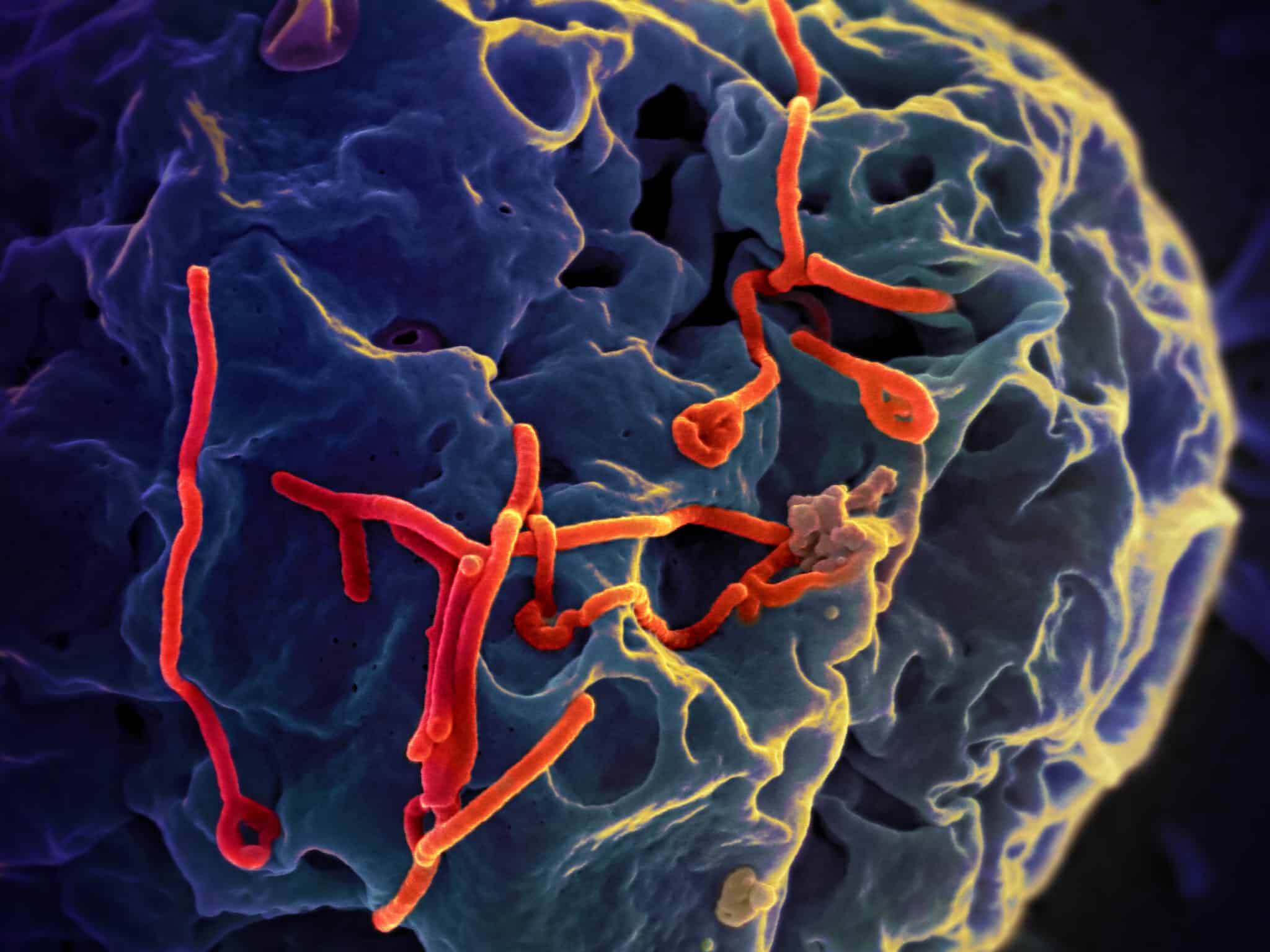 The head of the CDC: international community fails to contain the Ebola virus, there is a threat of an epidemic