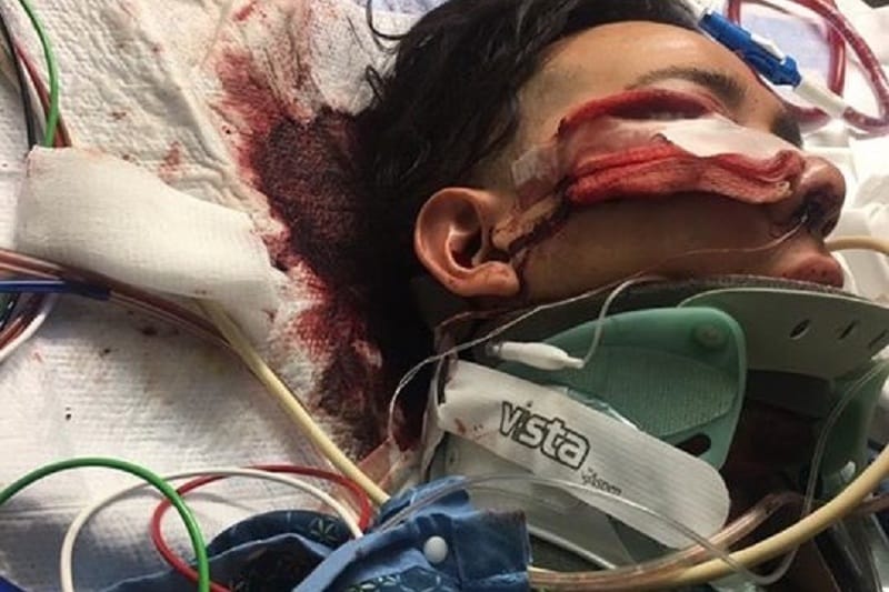 In Utah a man with an iron pipe beaten by Latinos shouting: «I’m here to kill a Mexican!»