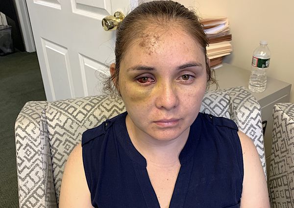 «Go back to Mexico»: the American woman lost consciousness after she was beaten by the school bully, who threatened her son