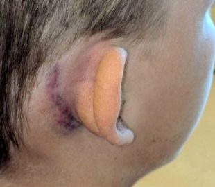 The child six hours was bleeding from his ears after the attack the men, who decided that he «respects» the US national anthem