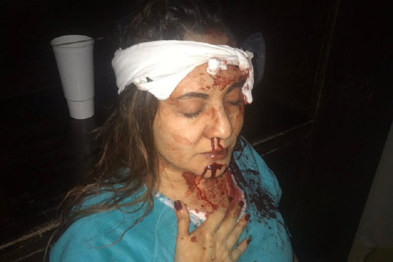 Horrifying pictures: former managing Amazon was brutally beaten with a bat wife before her murder